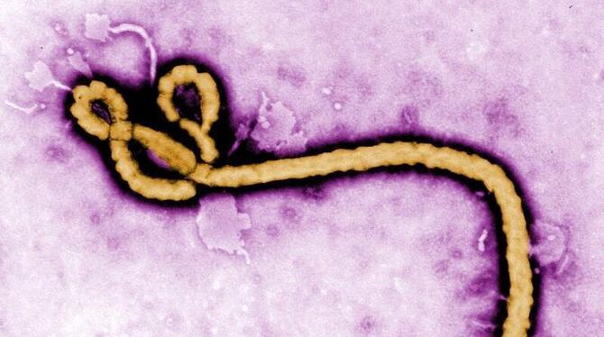 Ebolavirus: Gegen Ebola gibt es weder eine Schutzimpfung noch eine Therapie. Foto: Frederick A. Murpy / Cdc Handout