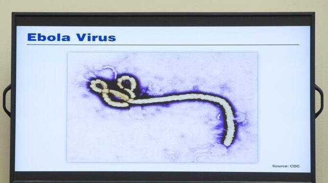 Fieber, Unwohlsein, Durchfall und Erbrechen: Bei solchen Symptomen sollte sich jeder, der zuvor in einem Ebola-Land war, umge