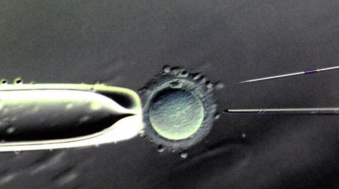 Befruchtung einer weiblichen Eizelle im Labor. Foto: Waltraud Grubitzsch/Archiv