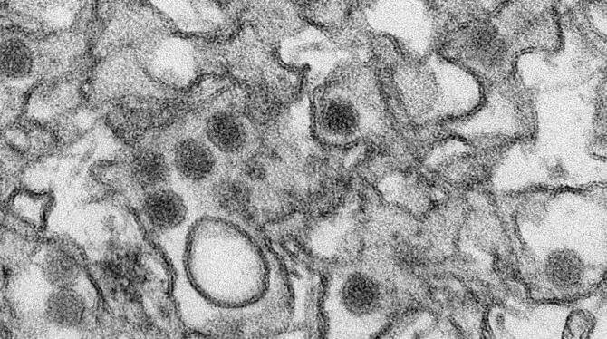 Das gefährliche Zika-Virus unter dem Elektronenmikroskop. Foto: CDC/Cynthia Goldsmith/dpa