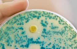 Indikatorkulturplatte zum Nachweis von resistenten Bakterien: Die Zahl der Krankheitsfälle mit Erregern, die gegen alle gängigen