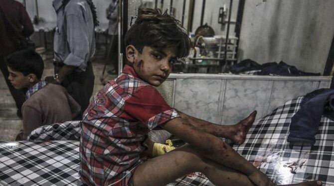 Nach einem Luftangriff sitzt ein verletzter Junge in einem Krankenhaus im syrischen Douma. Foto: Mohammed Badra/Archiv