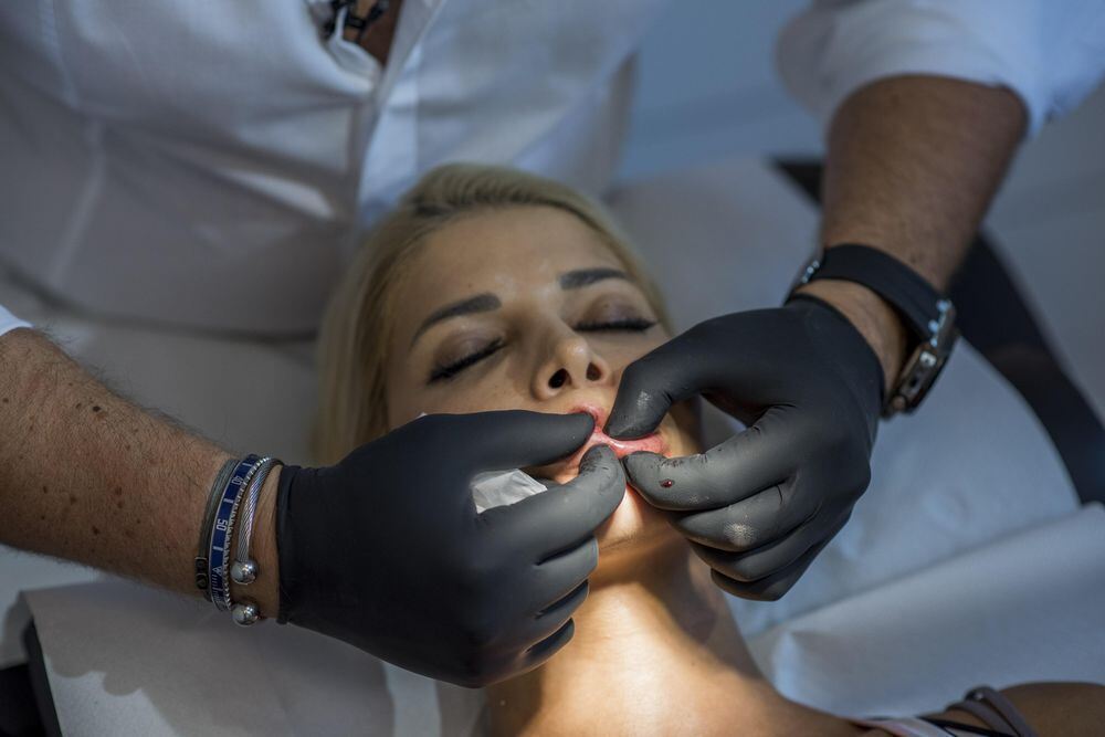 Volle Lippen für Micaela Schäfer: Die OP in Bildern