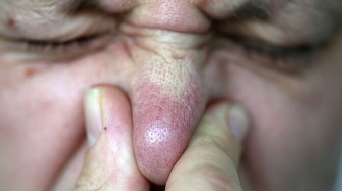 Kunden sollen in Läden nicht die Nase rümpfen müssen. Kunden sollen in Läden nicht die Nase rümpfen müssen.