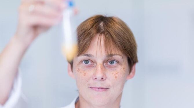 Eine Mitarbeiterin vom Chemischen Veterinäruntersuchungsamt Münsterland-Emscher-Lippe nimmt in Münster   Eimasse in Augensche