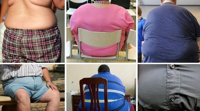 Fettleibigkeit nimmt in immer mehr Ländern das Ausmaß einer Volkskrankheit an.