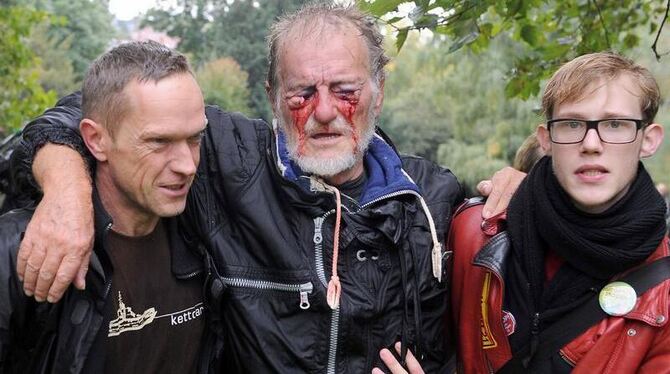 Das Bild des verletzten Demonstranten wurde in den Medien ein Symbol für die Härte des Polizeieinsatzes in Stuttgart.
