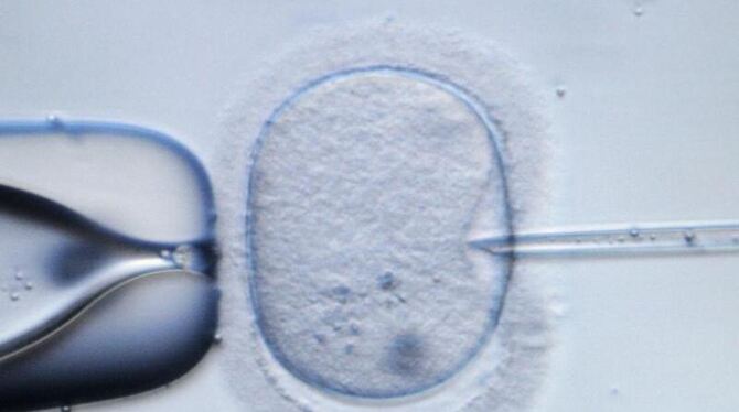 Die mikroskopische Aufnahme zeigt eine menschliche Eizelle, in die in einem Dresdner Speziallabor eine Injektionsnadel eingef