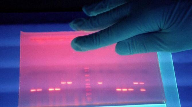 Untersuchung von fluoreszierender DNS von EHEC-Bakterien in einem Labor in der Außenstelle Wernigerode des Robert-Koch-Instit