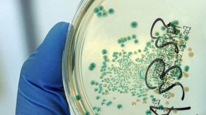 Immerhin: Das Erbgut des grassierenden EHEC-Bakteriums ist entschlüsselt.