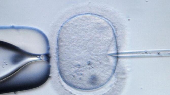 Mikroskopische Aufnahme einer menschliche Eizelle, in die zu Demonstrationszwecken eine Injektionsnadel eingeführt wird. (Arc