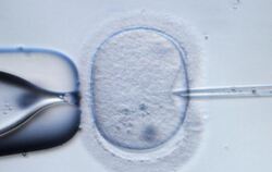Mikroskopische Aufnahme einer menschliche Eizelle, in die zu Demonstrationszwecken eine Injektionsnadel eingeführt wird. (Arc