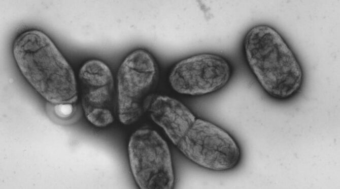 Das Pest-Bakterium namens Yersinia pestis