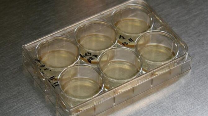 Humane embryonale Stammzellen tiefgefroren (kryokonserviert) in einer Kulturschale. Archivfoto: Christian Ender
