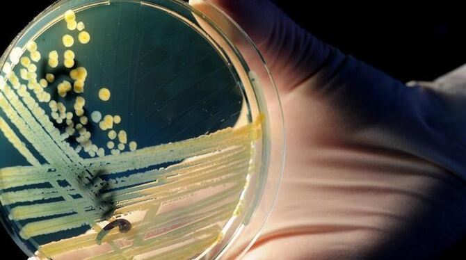 Schale mit Kolonien des aggressiven Darmkeims EHEC: Mediziner warnen davor, dass es keine Gewähr dafür gibt, dass neue Infekt