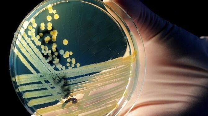STEC-Bakterien können dramatisch verlaufende Durchfallerkrankungen hervorrufen. Foto: Julian Stratenschulte / Archiv
