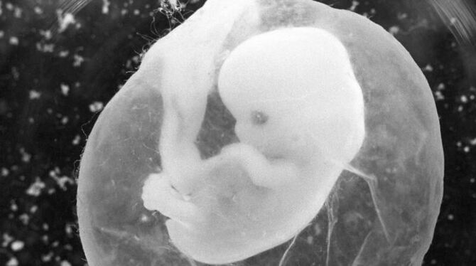 Das undatierte Foto zeigt einen sieben Wochen alten Fötus in einer Fruchtblase. Erstmals seit Jahren ist die Zahl der Schwang