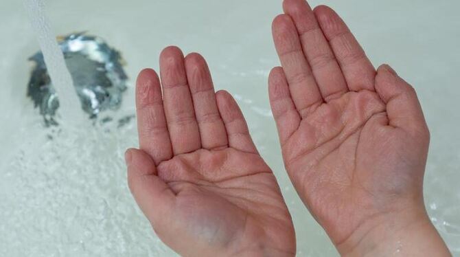 Ob in der Badewanne oder beim Spülen des Geschirrs - sind die Hände längere Zeit unter Wasser, werden die Finger schrumpelig.