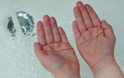 Ob in der Badewanne oder beim Spülen des Geschirrs - sind die Hände längere Zeit unter Wasser, werden die Finger schrumpelig.