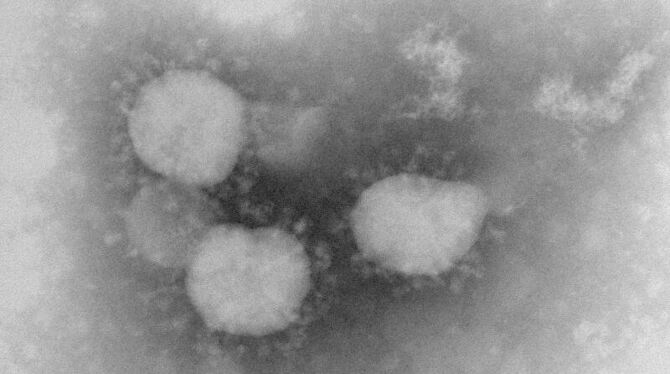 ngesichts von mehr als 20 Todesfällen hat die Weltgesundheitsorganisation (WHO) eindringlich vor dem neuen Coronavirus gewarn