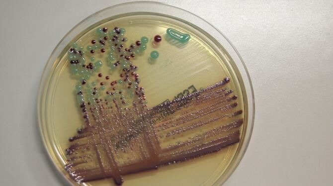 Präparat eines Escherichia coli Stammes. Escherichia coli ist ein Bakterium, das im menschlichen und tierischen Darm vorkommt. F