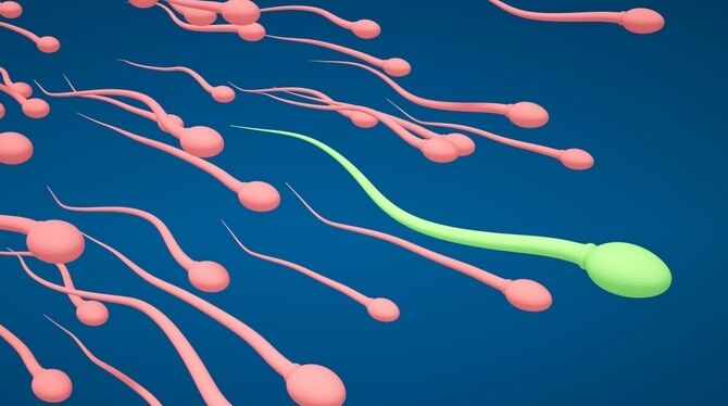 Spermien.