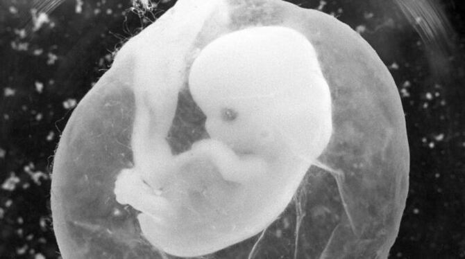 Das undatierte Foto zeigt einen sieben Wochen alten Fötus in einer Fruchtblase. Foto: Peter Endig/Archiv