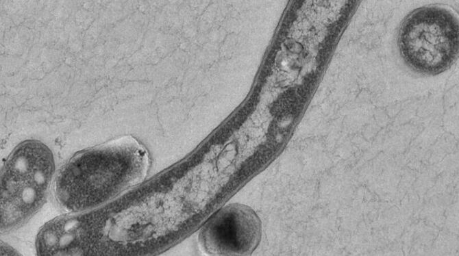 Der Tuberkulose-Erreger Mycobacterium tuberculosis. Foto: Robert-Koch-Institut/Gudrun Holland