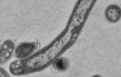 Der Tuberkulose-Erreger Mycobacterium tuberculosis. Foto: Robert-Koch-Institut/Gudrun Holland