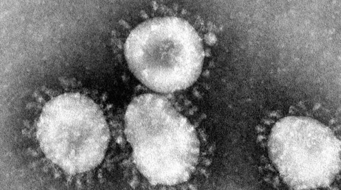 Das Handout des amerikanischen Centers for Disease Control (CDC) zeigt einen Coronavirus unter dem Mikroskop. Foto: Center fo