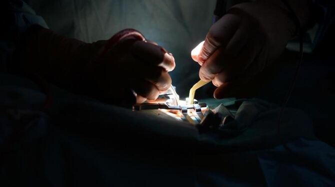 Ein Mediziner während einer Bandscheiben-OP. Eine Expertise gibt Aufschluss über die meisten Behandlungsfehler. Foto: Felix K