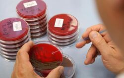 Agarplatten mit Bakterienkulturen: Kritiker warnen, dass ESBL-Keime beim Einsatz von Antibiotika ins Fleisch gelangen können.