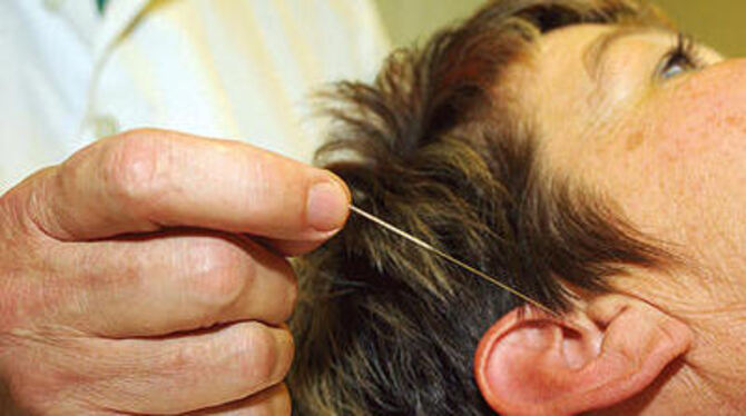Akupunktur - inzwischen eine anerkannte medizinische Methode in der Therapie von Migräne oder Spannungskopfschmerz. FOTO: NIETHA