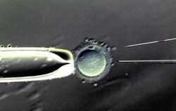 Befruchtung einer weiblichen Eizelle im Labor. Foto: Waltraud Grubitzsch/Archiv