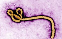 Ebolavirus. Fotoo: Frederick A. Murpy / Archiv Foto: Frederick A. Murpy / Cdc Handout