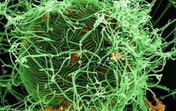 Unter dem Elektronenmikroskop: Partikel eines Ebola-Virus. FOTO: NIAID