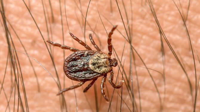 Eine Zecke krabbelt über den Arm eines Mannes.