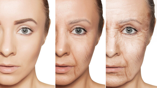 Altern: Die Computersimulation zeigt typische Veränderungen.  FOTO: FOTOLIA