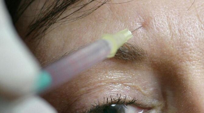 Eine Frau erhält auf ihrer Stirn eine Injektion