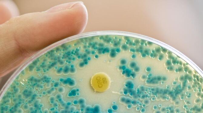 Antibiotikaresistente Keime Antibiotikaresistente Keime