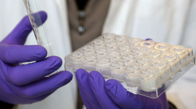 Mit verschiedenen Labor-Methoden wird versucht, einen Ersatz für Tierversuche zu finden.  FOTO: DPA