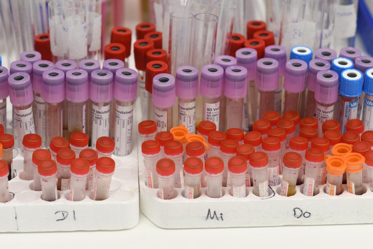 Blutproben im Labor.