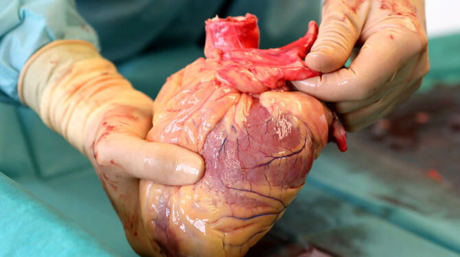 Das Herz eines Verstorbenen, das Leben retten soll. Ein Transplantationsmediziner hält in der Pathologie des Südstadt-Klinikums