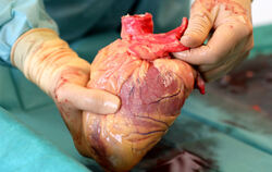 Das Herz eines Verstorbenen, das Leben retten soll. Ein Transplantationsmediziner hält in der Pathologie des Südstadt-Klinikums 