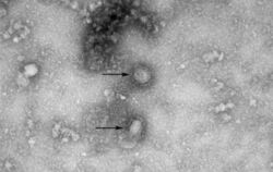 Eine Mikroskopaufnahme zeigt den neuen Stamm des Coronavirus