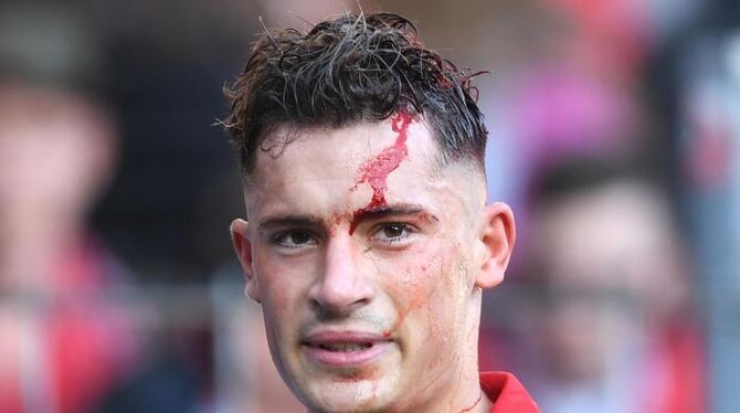 Freiburgs Spieler Robin Koch mit einer Kopfverletzung