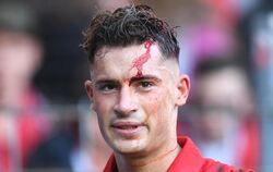 Freiburgs Spieler Robin Koch mit einer Kopfverletzung