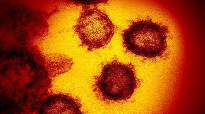 Coronavirus