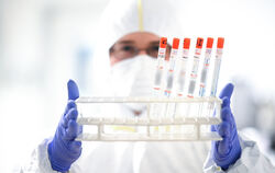 Das Coronavirus, hier ein Ständer mit diversen Abstrichen, hält das Gesundheitssystem in Europa auf Trab.  FOTO: DPA