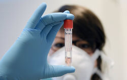 Für einen Test auf das Coronavirus gibt es ganz konkrete Vorgaben.  FOTO: DPA